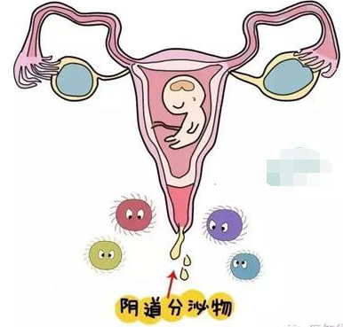 阴道分泌物黄瓜视频成人A片免费观看的一般性状检查类型