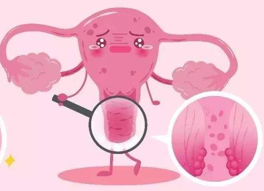 白带常规在线观看黄瓜视频厂家提醒女士做好私密处清洗