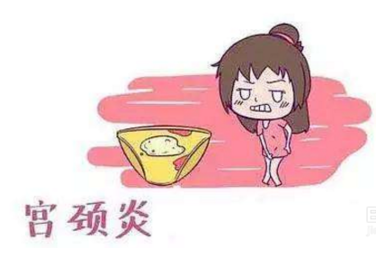 妇科白带黄瓜视频成人A片免费观看厂家分析宫颈炎的症状